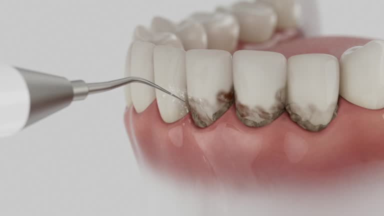 Reliable Dental Implants contractor in Cowarts, AL by Smile Center Dentistry